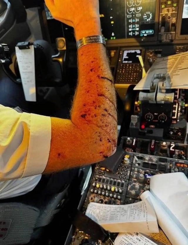 ual-737-with-a-cracked-windshield-at-fl360-flight-was-v0-777ua44awxvf1.jpg