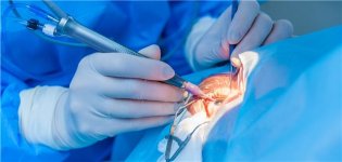 Augen-Operation-Prognoseentscheidend-ist-bei-einer-202643.jpg